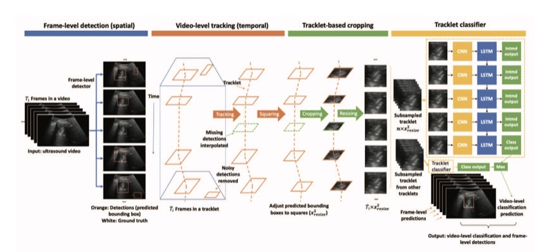 Figure from “Weakly Semi-supervised Detector-based Video Classification with Temporal Context for Lung Ultrasound”