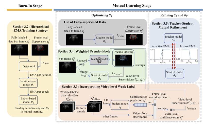 Figure from “Weakly Semi-supervised Detection in Lung Ultrasound Videos”