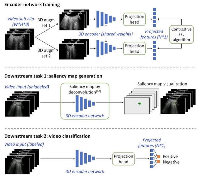 Figure from “Contrastive self-supervised learning for spatio-temporal analysis of lung ultrasound”