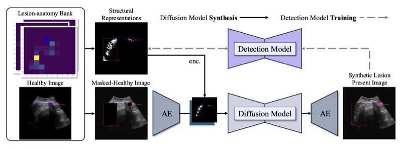 Figure from “Ultrasound Image Synthesis Using Generative AI for Lung Consolidation Detection”
